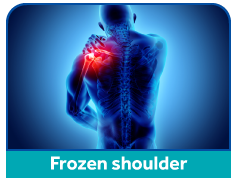 frozen-shoulder